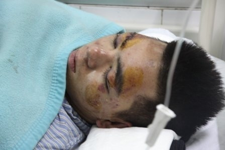 Em Thái Duy Mạnh đang được gia đình cấp cứu tại viện Xanh Pôn sau đêm bị đám thanh niên lạ mặt đánh hội đồng. Em Thái Duy Mạnh đang được gia đình cấp cứu tại viện Xanh Pôn sau đêm bị đám thanh niên lạ mặt đánh hội đồng.