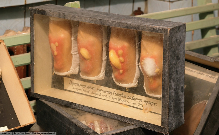 Những mẫu mô tả triệu chứng nhiễm độc hóa học