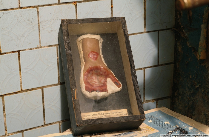 Những mẫu mô tả triệu chứng nhiễm độc hóa học