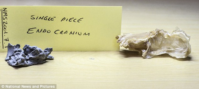 Qua nghiên cứu lại hộp sọ của loài cá mập tiền sử này đã cho các nhà khoa học những thông tin mới về quá trình tiến hoá của động vật có xương sống thời tiền sử. Qua nghiên cứu lại hộp sọ của loài cá mập tiền sử này đã cho các nhà khoa học những thông tin mới về quá trình tiến hoá của động vật có xương sống thời tiền sử.