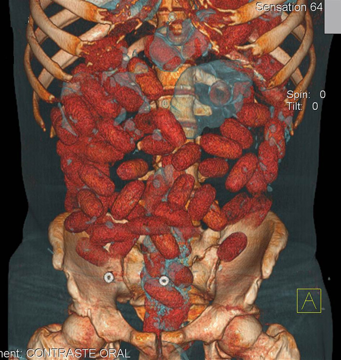 Ngày 12/9/2011 cảnh sát Brazil đã bắt giữ một công dân Ireland với 72 túi cocaine nuốt trong dạ dày tại sân bang Congonhas, Sao Paulo.