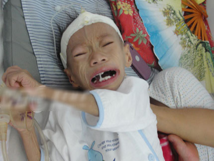 Cháu Hứa Văn Dũng khi ở viện Nhi. Cháu Hứa Văn Dũng khi ở viện Nhi.