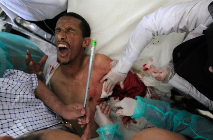 Một người đàn ông tham gia biểu tình và bị bắn trọng thương ở Sanaa, Yemen ngày 23/10/2011.