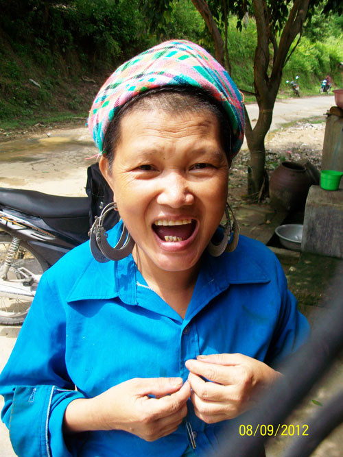 Chị Vàng Thị Rủ chỉ còn 4 chiếc răng ở hàm dưới.