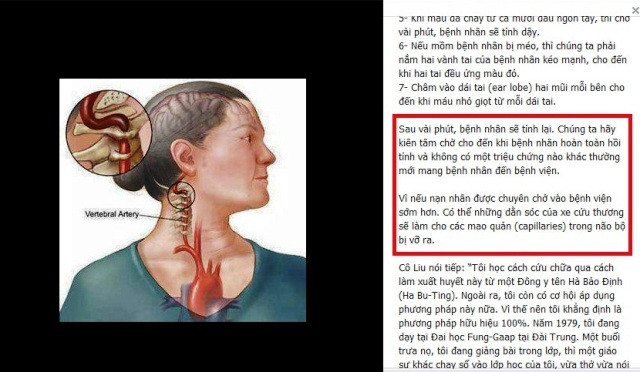 Bài viết trên Facebook đã nhận hàng ngàn cảm ơn và chia sẻ nhưng lại là một tư vấn sai lầm về cách cấp cứu nạn nhân bị tai biến. Bài viết trên Facebook đã nhận hàng ngàn cảm ơn và chia sẻ nhưng lại là một tư vấn sai lầm về cách cấp cứu nạn nhân bị tai biến.
