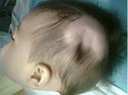 Bé Hồ G. H lúc vừa nhập viện Bé Hồ G. H lúc vừa nhập viện