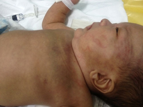 Bé trai vô danh bị xây xát do giẫm đạp.