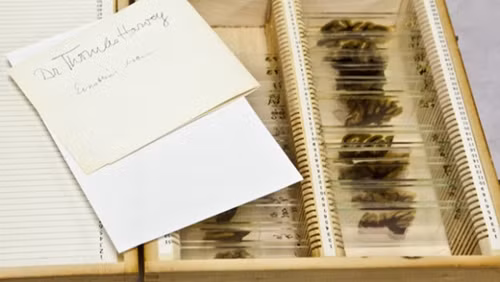 Bộ não của Einstein ảnh 2