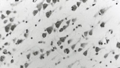 Bộ não của Einstein ảnh 3