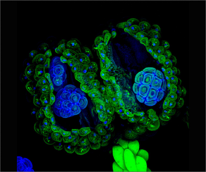 Các bao phấn của loài cây Acacia dealbata được chụp lại bởi giáo sư Marta Guervos thuộc bộ phận xử lý hình ảnh, Viện khoa học-kỹ thuật , trường Đại học Oviedo trong Asturias, Tây Ban Nha. Các bao phấn của loài cây Acacia dealbata được chụp lại bởi giáo sư Marta Guervos thuộc bộ phận xử lý hình ảnh, Viện khoa học-kỹ thuật , trường Đại học Oviedo trong Asturias, Tây Ban Nha.