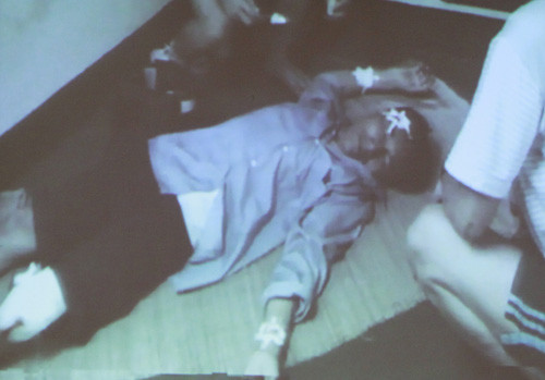 Một Kiểm ngư viên của Việt Nam bị thương do mảnh kính bắn vào khi tàu Trung Quốc dùng vòi rồng phun nước làm vỡ kính trên tàu khi ngăn chặn hành động phi pháp của tàu thuyền Trung Quốc ảnh Thanhnien