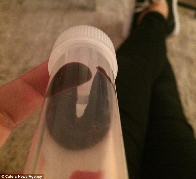 Con đỉa đã làm tổ trong mũi Daniela Liverani Con đỉa đã làm tổ trong mũi Daniela Liverani