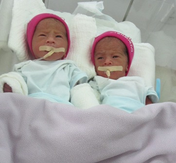 Hai em bé này đều có cân nặng 1,3kg và yếu hơn các bé khác. Ảnh TN