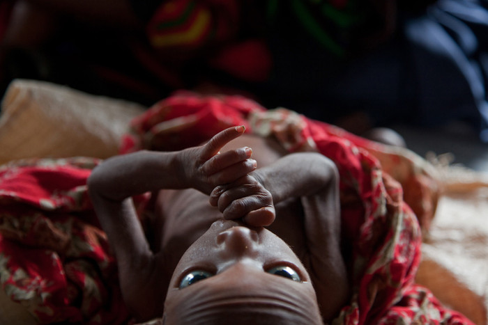 Khu vực Sừng Châu Phi nghèo đói hiện nay đang phải chịu đựng thảm kịch hạn hán và mất mùa tồi tệ nhất trong vòng 100 năm qua. Khu vực Sừng Châu Phi nghèo đói hiện nay đang phải chịu đựng thảm kịch hạn hán và mất mùa tồi tệ nhất trong vòng 100 năm qua.