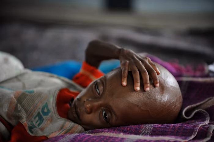 Khu vực Sừng Châu Phi nghèo đói hiện nay đang phải chịu đựng thảm kịch hạn hán và mất mùa tồi tệ nhất trong vòng 100 năm qua.