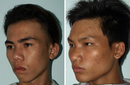 Đối tượng Nguyên và Nghĩa Đối tượng Nguyên và Nghĩa