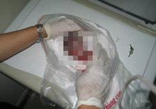 Hài nhi xấu số chết oan bởi sự vô lương tri của người lớn (Ảnh minh họa) Xot long vu xac thai nhi bi nem di nem lai