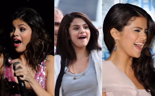 Nói thật là Selena Gomez nên cười kiểu này ít thôi.