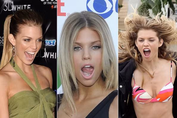AnnaLynne McCord, bồ cũ của ma cà rồng Kellan Lutz có điệu cười như sắp sửa... nuốt chửng cái gì đó ấy nhỉ?