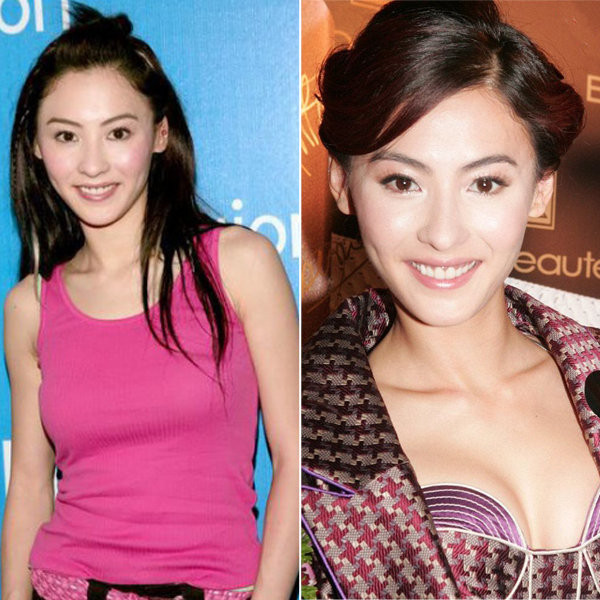 “Bà mẹ hai con” Trương Bá Chi đã không ít lần phải đau đầu vì tin đồn nâng ngực. Tuy nhiên, theo một nguồn tin từ báo chí Hong Kong, chính vào thời điểm chia tay với Tạ Đình Phong cô đã giải khuây bằng cách đi nâng ngực. “Bà mẹ hai con” Trương Bá Chi đã không ít lần phải đau đầu vì tin đồn nâng ngực. Tuy nhiên, theo một nguồn tin từ báo chí Hong Kong, chính vào thời điểm chia tay với Tạ Đình Phong cô đã giải khuây bằng cách đi nâng ngực.