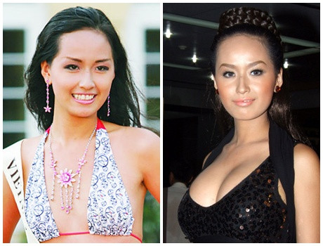 Hoa hậu Mai Phương Thúy bơm vá quá đà là điều ai cũng có thể nhận thấy. Từ vấn nạn sử dụng silincon nâng ngực (của công ty PIP - công ty này hiện đã bị khai tử) không đảm bảo chất lượng của phụ nữ Australia, Nam Mỹ, tới châu Âu; giờ đây hàng ngàn phụ nữ châu Á cũng đang dần lo lắng cho tính mạng và nhan sắc sau thẩm mỹ của bản thân. Hoa hậu Mai Phương Thúy bơm vá quá đà là điều ai cũng có thể nhận thấy. Từ vấn nạn sử dụng silincon nâng ngực (của công ty PIP - công ty này hiện đã bị khai tử) không đảm bảo chất lượng của phụ nữ Australia, Nam Mỹ, tới châu Âu; giờ đây hàng ngàn phụ nữ châu Á cũng đang dần lo lắng cho tính mạng và nhan sắc sau thẩm mỹ của bản thân.