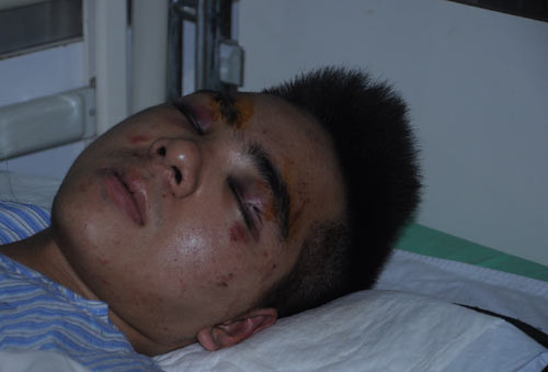 Phía nhà trường cho rằng có người lạ vào trường để đánh sinh viên Thái Duy Mạnh Phía nhà trường cho rằng có người lạ vào trường để đánh sinh viên Thái Duy Mạnh