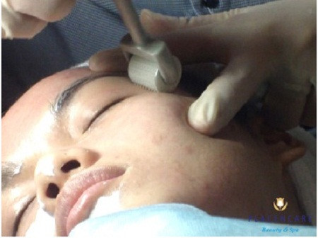 Những chiêu quảng cáo về thần dược tế bào gốc đang chiếm lĩnh thị trường làm đẹp Những chiêu quảng cáo về thần dược tế bào gốc đang chiếm lĩnh thị trường làm đẹp