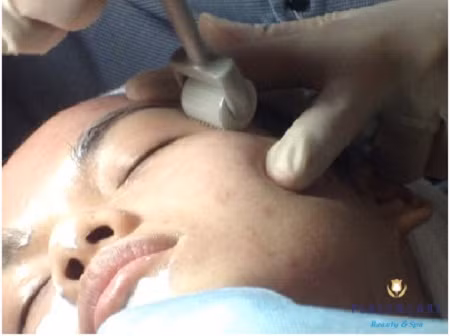 Những chiêu quảng cáo về thần dược tế bào gốc đang chiếm lĩnh thị trường làm đẹp