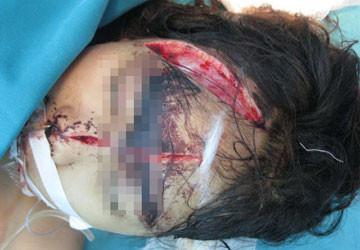 Tìm được mẫu máu của hung thủ vụ thảm sát Bắc Giang ảnh 2