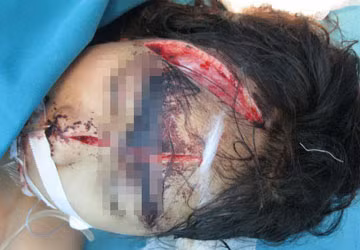 Tìm được mẫu máu của hung thủ vụ thảm sát Bắc Giang ảnh 2