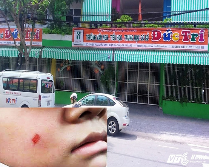 Trường Tiểu học - Trung học Cơ sở Đức Trí (Đà Nẵng) nơi xảy ra sự vụ phụ huynh tát vào mặt giáo viên (Ảnh: vtc.vn). Trường Tiểu học - Trung học Cơ sở Đức Trí (Đà Nẵng) nơi xảy ra sự vụ phụ huynh tát vào mặt giáo viên (Ảnh: vtc.vn).