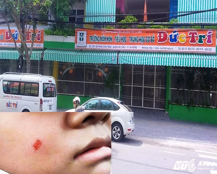 Thương con như thế bằng mười hại con