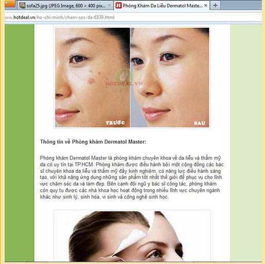 Không phép, không chuyên môn, nhưng phòng khám Dermatol Master vẫn quảng cáo, bán voucher trên rất nhiều trang mạng từ năm 2012 Không phép, không chuyên môn, nhưng phòng khám Dermatol Master vẫn quảng cáo, bán voucher trên rất nhiều trang mạng từ năm 2012