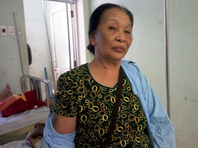Đôi vợ chồng già ở huyện Quảng Trạch (Quảng Bình) bị một thầy giáo đánh phải nhập viện Đôi vợ chồng già ở huyện Quảng Trạch (Quảng Bình) bị một thầy giáo đánh phải nhập viện
