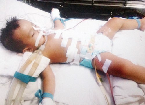 Bé Lợi bị 9 nhát dao trên người . Ảnh: Gia đình cung cấp. Bé Lợi bị 9 nhát dao trên người . Ảnh: Gia đình cung cấp.