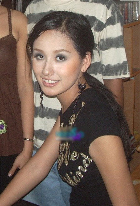 Cô lộ hàm răng và làn da đầy tỳ vết.