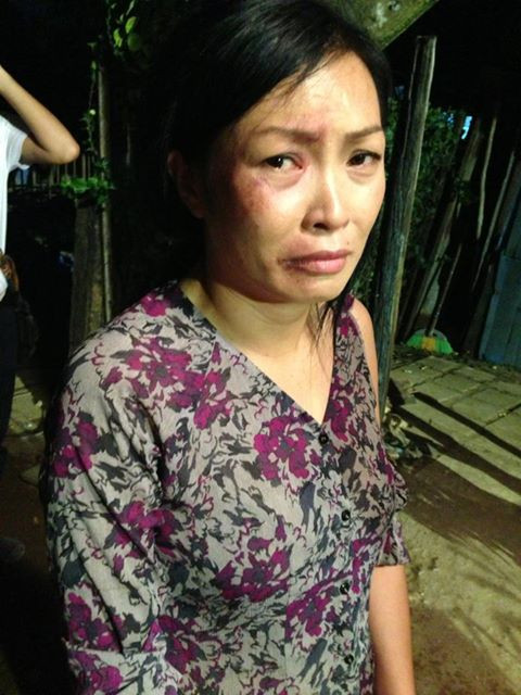 Sau những chia sẻ về dự định đám cưới trong buổi họp báo ra mắt album "Người đàn bà lúc nửa đêm", chị Chanh liền nghịch ngợm đăng trên trang cá nhân một bức hình đầy ấn tượng với chú thích: "Chưa lấy chồng bị chồng đánh rồi nè... Sao dám lấy nữa đây".