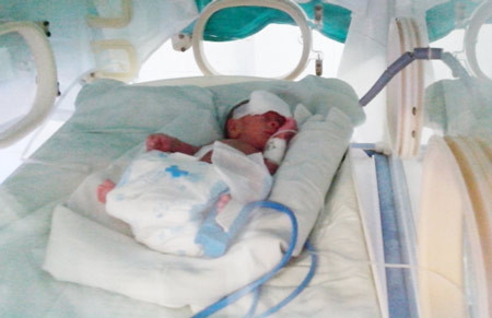 Bé Sỹ Cường lúc còn sống, được chăm sóc đặc biệt tại Bệnh viện Nhi Thanh Hoá. Bé Sỹ Cường lúc còn sống, được chăm sóc đặc biệt tại Bệnh viện Nhi Thanh Hoá.