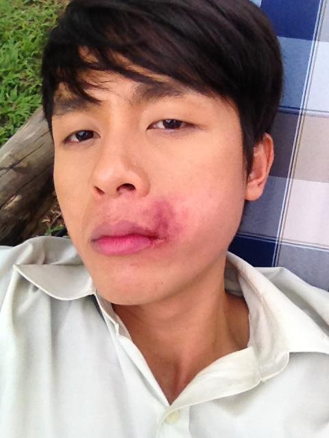 "Huhuhuhu bị đánh bầm dập tơi tả....huhuhuhu đóng phim thôi mà Huhuhu diễn viên giỏi quá được cái thiệt và rất nhiệt tình làm sưng mỏ rồi.....huhuhu" - Hòa Hiệp đăng hình ảnh hậu trường đóng phim.