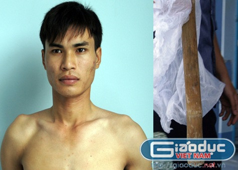 Trọng và chiếc gậy đánh vợ.