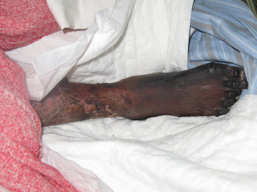 Chết vì tiết canh ảnh 2