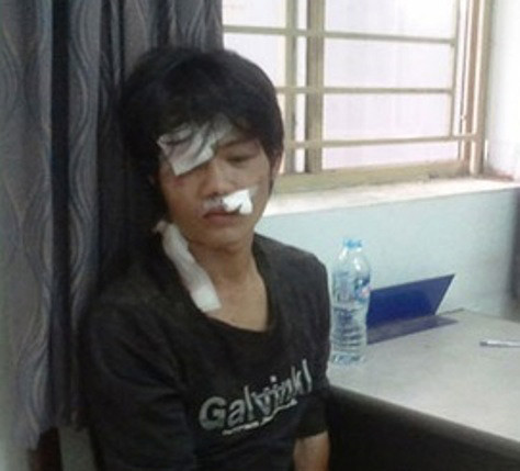 Phút sinh tử đối mặt tên cướp hung tợn ảnh 2 Phút sinh tử đối mặt tên cướp hung tợn, Cảnh giác, An ninh Xã hội, bat cuop, cuop tai san, dai uy canh sat, cuop giat, ten cuop, nguoi chet, tai nan giao thong, vu cuop, bao, tin tuc, tin an ninh