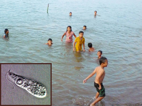 “Amip ăn não”: Hiểm nhưng hiếm ảnh 1