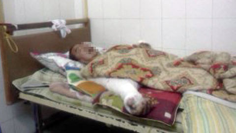 Ông L. trên giường bệnh. Dau don nguoi chong bi vo doi nuoc soi