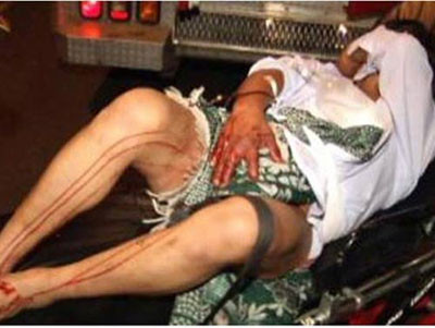 Nạn nhân đau đớn vì bị cắt "của quý". Ảnh minh họa