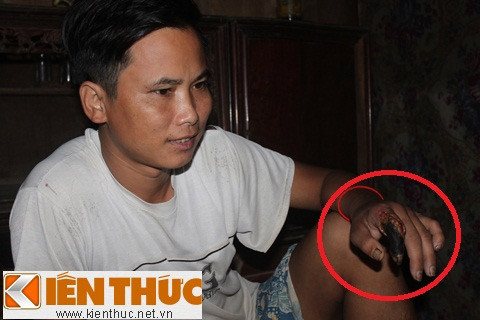 Suýt bỏ mạng vì "rắn thần" ảnh 1 Suýt bỏ mạng vì "rắn thần", Tin tức trong ngày, ran than, ran ho chua, ho mang chua, ran ho mang, ruou ran, ngam ruou ran, ngam ruou, ruou thuoc, ruou bo, thap toan dai bo, ruou bo duong, bao, tin hay, tin hot, tin tuc, vn