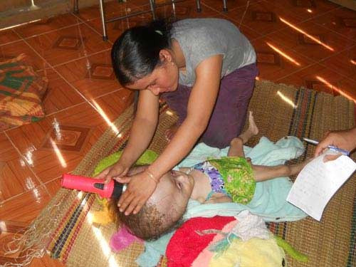 Bệnh lạ, bé 2 tuổi đầu to hơn nồi cơm điện ảnh 2 Bệnh lạ, bé 2 tuổi đầu to hơn nồi cơm điện, Tin tức trong ngày, Benh la, dau to, ma rung, dau co chat long, benh vien, bac si, Quang Nam, nganh y te, suc khoe, bao.