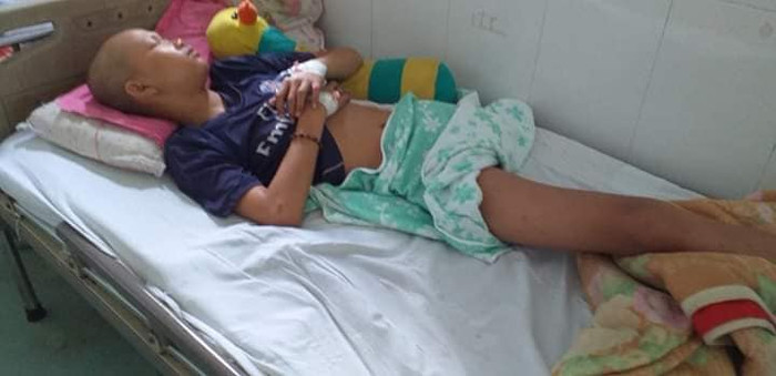 Em Duy Phương sau khi bị cắt chân (Ảnh gia đình cung cấp) Em Duy Phương sau khi bị cắt chân (Ảnh gia đình cung cấp)