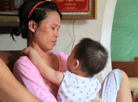 Sau vụ cháy ở HP: "Sống không bằng chết" ảnh 1 Sau vụ cháy ở HP: "Sống không bằng chết", Tin tức trong ngày, chay xuong may hai phong, chay o hai phong, chay xuong may, hoa hoan, chay nha, chay, chay xuong, nguoi bi thieu chet, bao, tin nhanh, tin hot, tin tuc