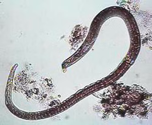 Tàn phế, tử vong vì... tiết canh, Tin tức trong ngày, nhiem trung huyet, hoai tu chan tay, khuan Ecoli, long lon tiet canh, giun xoan, vi khuan ta, vi khuan li, thuc pham ban